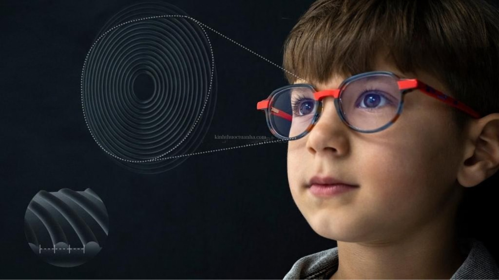 Tròng kính Zeiss MyoCare: Kiểm soát cận thị trẻ em 4 Tròng kính Zeiss MyoCare: Kiểm soát cận thị trẻ em - Ảnh 2